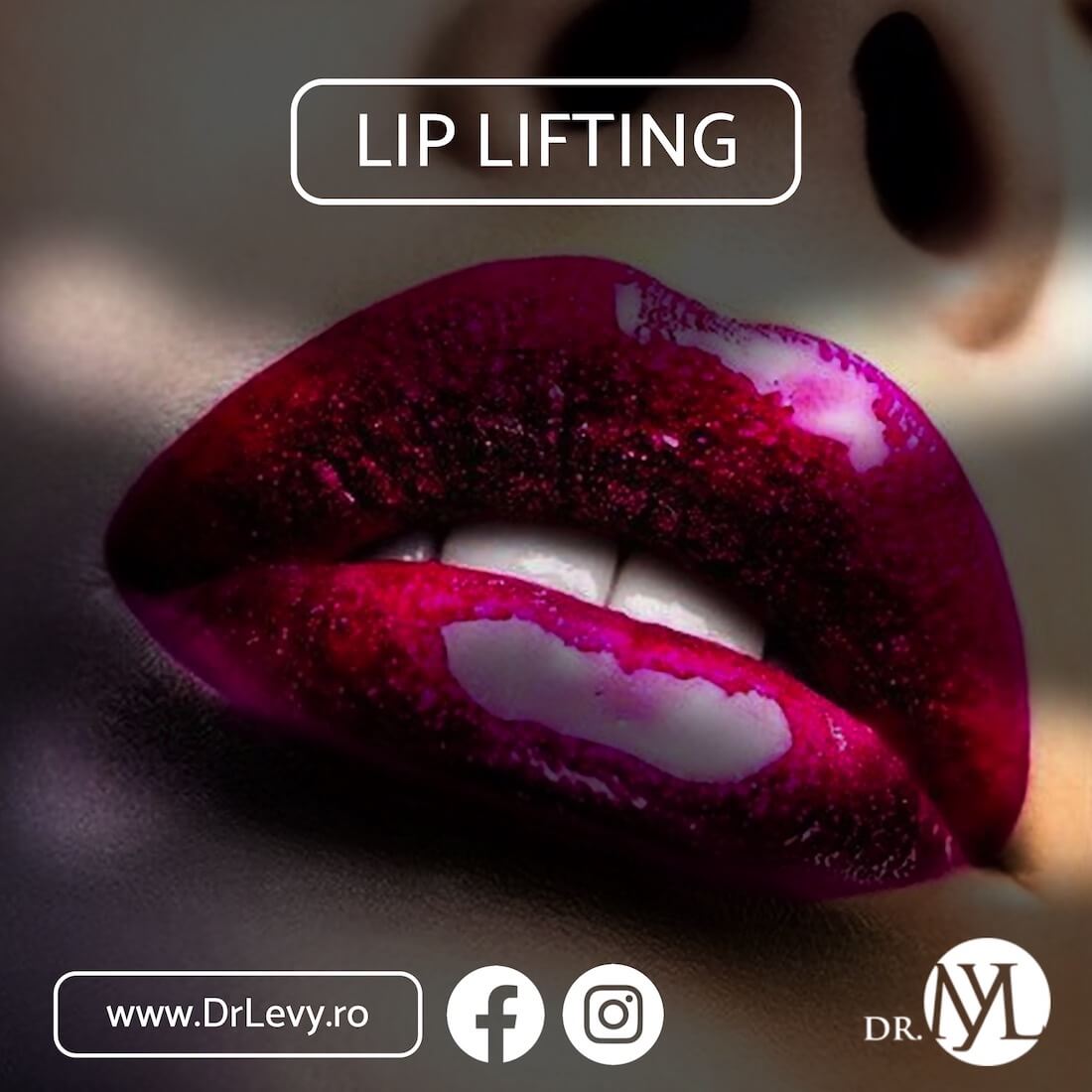 lip lifting