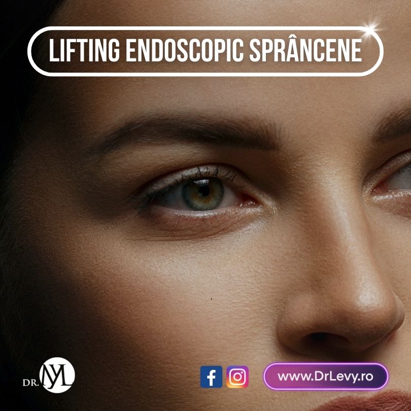 lifting endoscopic sprancene