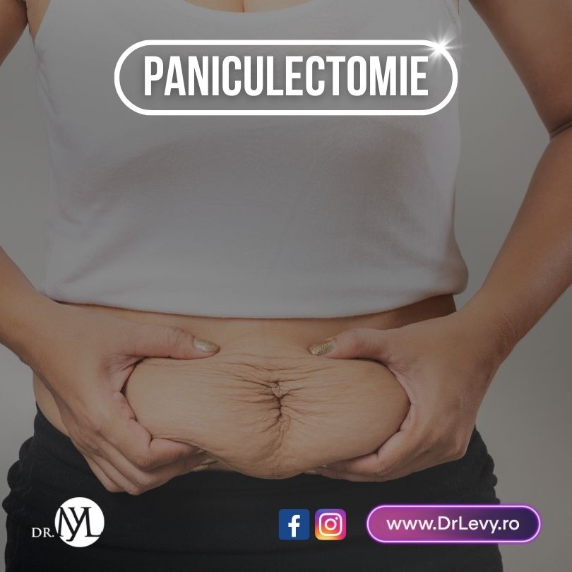 paniculectomie